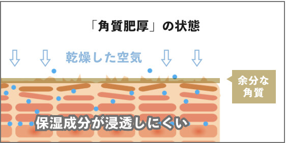 「角質肥厚」の状態