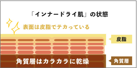 「インナードライ肌」の状態：表面は皮脂でテカっている、角質層はカラカラに乾燥